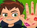 Гра Ben10 Ручний лікар  онлайн