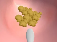 Earwax Clinic — безкоштовна онлайн гра