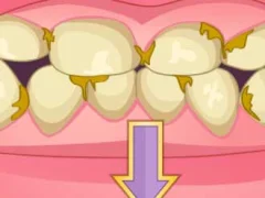 Bad Teeth Makeover — безкоштовна онлайн гра