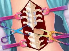 Anna Scoliosis Surgery — безкоштовна онлайн гра