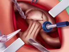 Princess Hips Surgery — безкоштовна онлайн гра