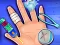 Hand Treatment — безкоштовна онлайн гра
