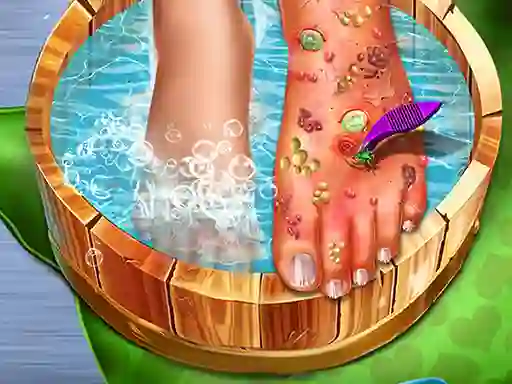 Feet Skin Doctor — безкоштовна онлайн гра