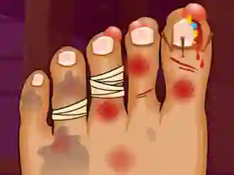 Monster Foot Doctor — безкоштовна онлайн гра