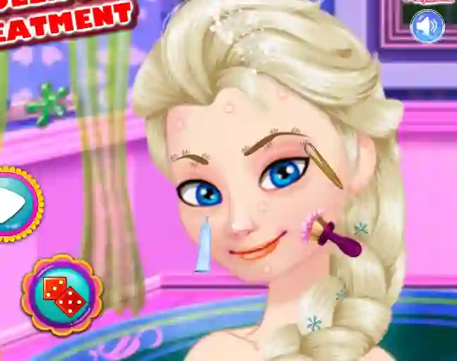 Ice Queen Acne Treatment — безкоштовна онлайн гра