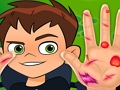 Гра Ben10 Ручний лікар  онлайн